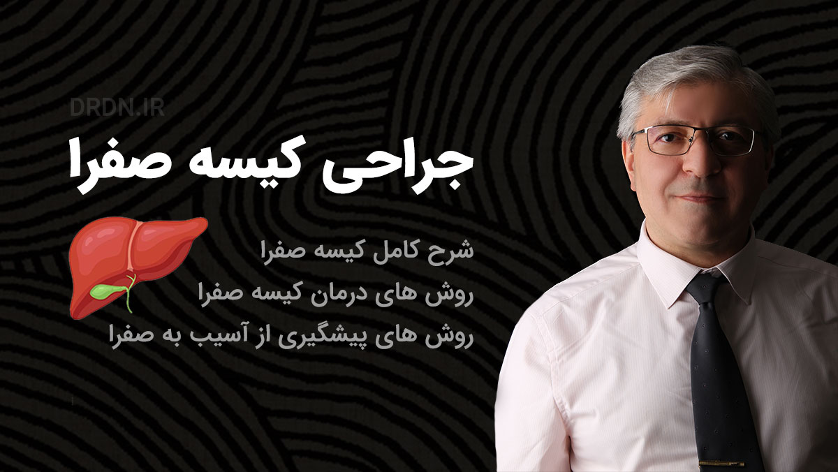 بهترین جراح کیسه صفرا