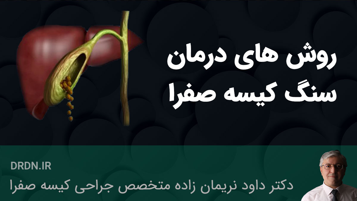 بهترین جراح کیسه صفرا